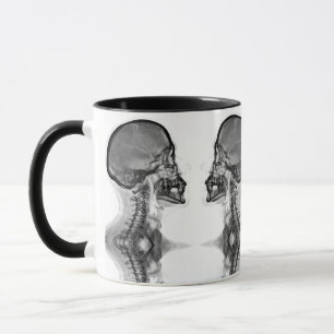 Caneca Radiologica