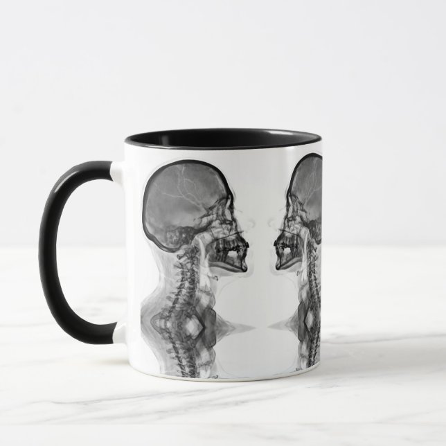 Caneca Radiologica (Esquerda)