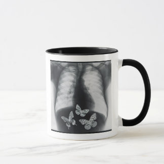 Caneca Raio X das borboletas no estômago