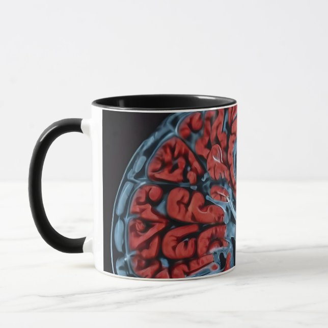 Caneca ressonância magnética cerebral (Esquerda)