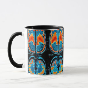 Caneca ressonância magnética cerebral