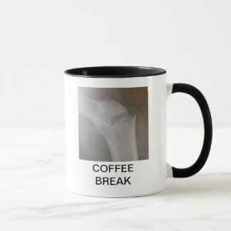 CANECA RUPTURA DE CAFÉ