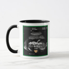 Caneca Sonograma Bebê chegando Anúncio para tia