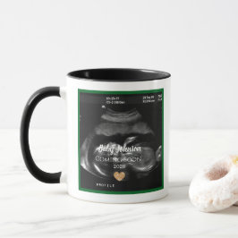Caneca Sonograma Bebê chegando Anúncio para tia