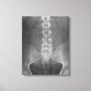 Canvas de arte digital em raios X