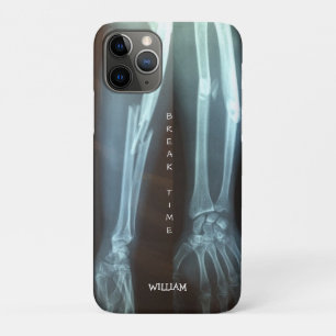 Capa Para iPhone 11 Pro Radius quebrado e Ulna Xray "Break Time"