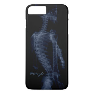 Capa Para iPhone Da Case-Mate Raio X bonito, personalizado do corpo