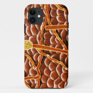 Capa Para iPhone Da Case-Mate Fungo do oídio pulverulento na poinsétia