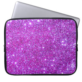 Capa Para Notebook Caixa 1 do laptop dos Sparkles do brilho do rosa