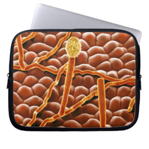 Capa Para Notebook Fungo do oídio pulverulento na poinsétia