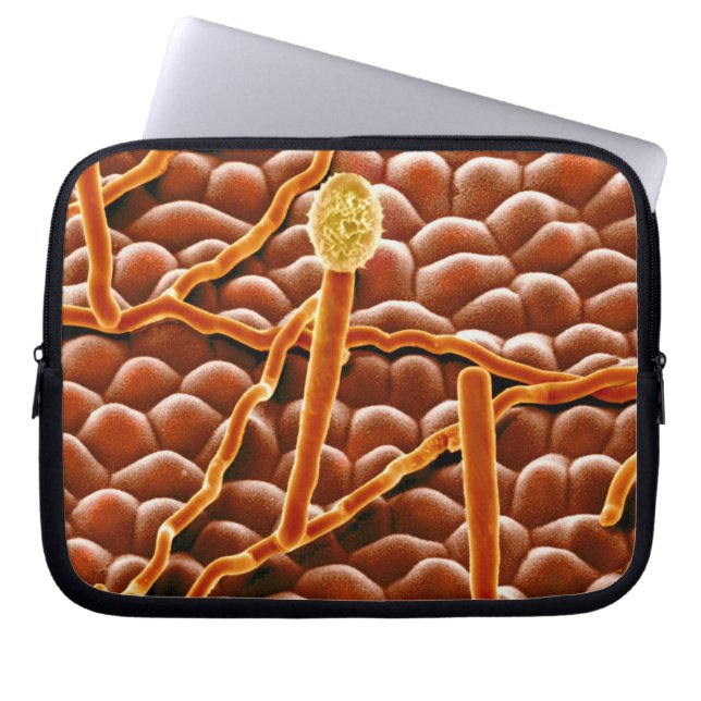 Capa Para Notebook Fungo do oídio pulverulento na poinsétia (Frente)