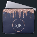 Capa Para Notebook Glitter Dourado Rosa Azul-Marinho Girly Monograma<br><div class="desc">Girly Blush Pink - Rosa Dourado e Marinho Blue Faux Glitter Drives e Sparkle Elegant Monogrammed Initials Case. Esse caso pode ser personalizado para incluir seu nome inicial e próprio.</div>