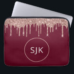 Capa Para Notebook Glitter Dourado, Rosa, Girly Burgundy, Monograma<br><div class="desc">Girly Blush Pink - Rosa Dourado e Preto - Discos com Brilho e Minúscula Elegante Monogramas. Esse caso pode ser personalizado para incluir seu nome inicial e próprio.</div>