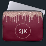 Capa Para Notebook Glitter Dourado, Rosa, Girly Burgundy, Monograma<br><div class="desc">Girly Blush Pink - Rosa Dourado e Preto - Discos com Brilho e Minúscula Elegante Monogramas. Esse caso pode ser personalizado para incluir seu nome inicial e próprio.</div>