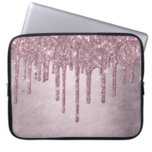 Capa Para Notebook Glitter Girly Dusty Mauve Shimmer Rosa