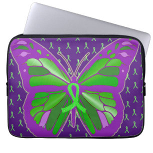 Capa Para Notebook Manteiga da Faixa de Opções para a Sensibilização 
