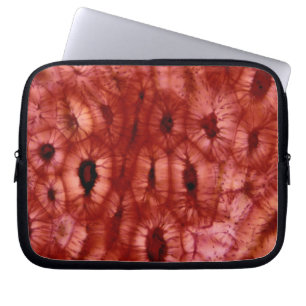 Capa Para Notebook Pilhas de Sclerenchyma de um poço da cereja