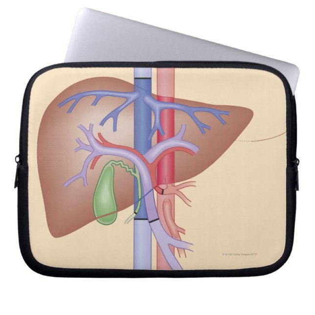 Capa Para Notebook Procedimento de transplante hepático (Frente)