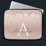 Capa Para Notebook Rosa Rosa Rosa Rosa Rosa Dourada, Brilhante e Mono<br><div class="desc">Rosa rosa rosa Dourada Faux Glitter e Sparkle Elegant Monograma Case. Esse caso pode ser personalizado para incluir seu nome inicial e próprio.</div>