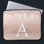 Capa Para Notebook Rosa Rosa Rosa Rosa Rosa Dourada, Brilhante e Mono<br><div class="desc">Rosa rosa rosa Dourada Faux Glitter e Sparkle Elegant Monograma Case. Esse caso pode ser personalizado para incluir seu nome inicial e próprio.</div>