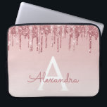 Capa Para Notebook Rosa Rosa Rosa Rosa Rosa Dourada, Brilhante e Mono<br><div class="desc">Cor-de-rosa-pincelada - Rosa Dourada,  brilho de popa fina e Laptop de monograma elegante e cintilante. Este caso monograma pode ser personalizado para incluir seu nome inicial e próprio.</div>