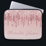 Capa Para Notebook Rosa Rosa Rosa Rosa Rosa Ouro, Brilhante Monograma<br><div class="desc">Cor-de-rosa-pincelado - Rosa Dourada,  brilho de popa fina e cinza Elegante monograma,  caixa de Laptop ou Capa para computador giro-catita. Este caso pode ser personalizado para incluir o nome do script de assinatura.</div>