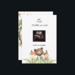 Cartão De Agradecimento Ultrassom Baby Boy Funny Woodland<br><div class="desc">Cartões de agradecimentos de Chá de fraldas de fotografia ultrassom. Perspectiva do bebê. Obrigado do Bebê. Animais dormindo na floresta. Rapaz. Pule.</div>