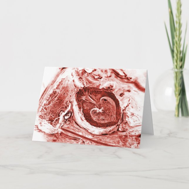 Cartão De Festividades morrendo (Frente)