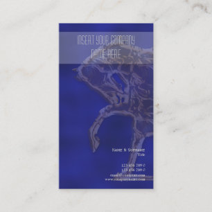 Cartão De Visita Ouro de prata azul do marketing de negócio do
