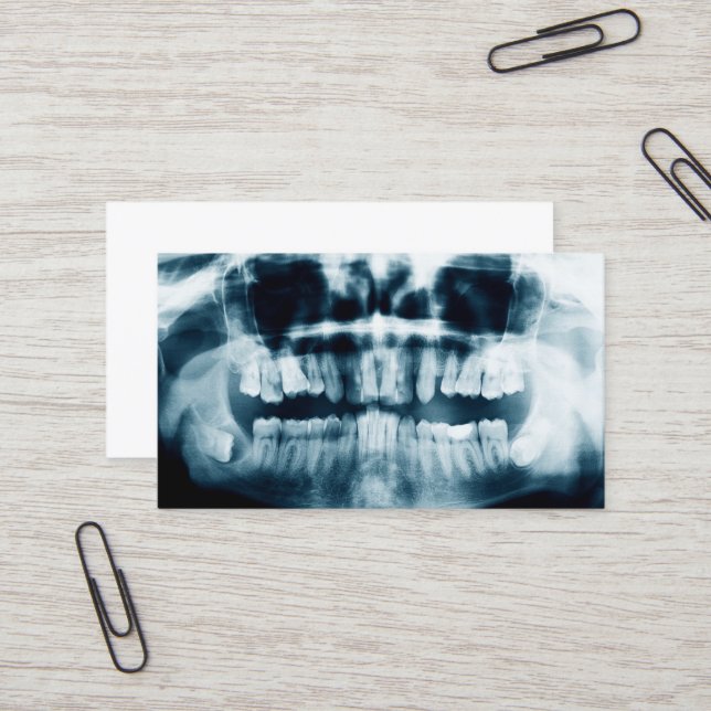 Cartão De Visita Raio-X dos dentes (Frente/Verso In Situ)