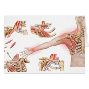 Cartão Ilustração Médica Detalhando Saída Tórica