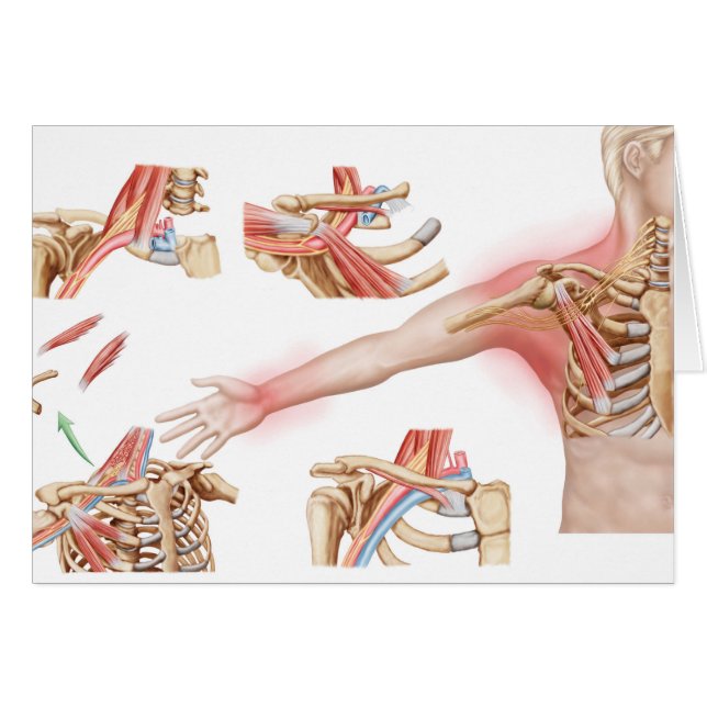 Cartão Ilustração Médica Detalhando Saída Tórica (Frente Horizontal)