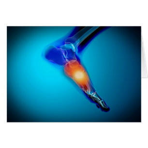 Cartão Imagem Conceitual Da Dor No Pé Humano