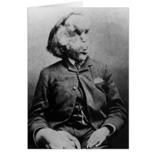 Cartão Joseph "John" Merrick O Homem Elefante de 1889