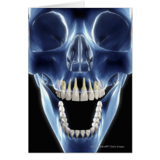 Cartão Olhar do estilo do raio X nos dentes humanos