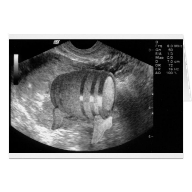 Cartão Placa cara (Frente Horizontal)