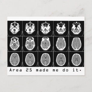 Cartão Postal A área 25 fez-me fazê-lo.