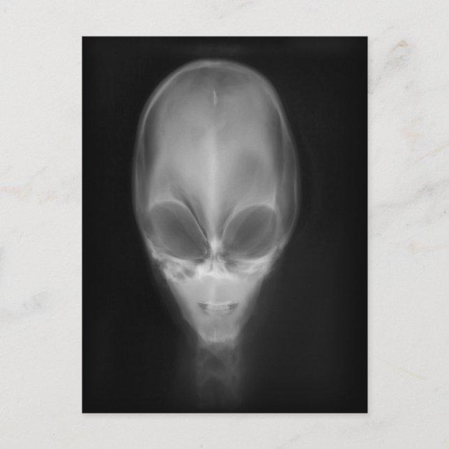 Cartão Postal Alienígena Skull X-ray (Frente)