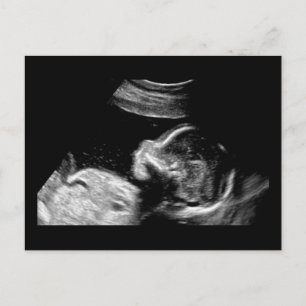 Cartão Postal Bebê