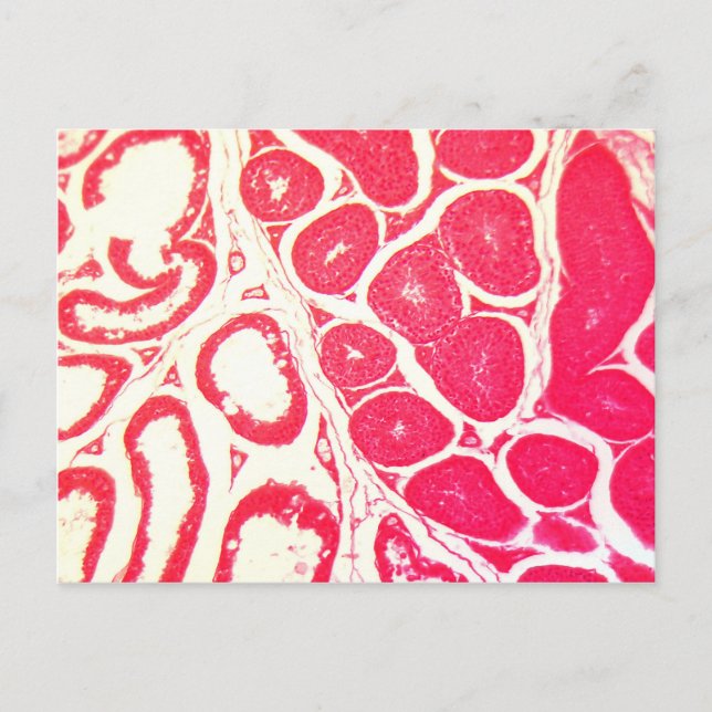 Cartão Postal Células de Testícula no Microscópio (Frente)