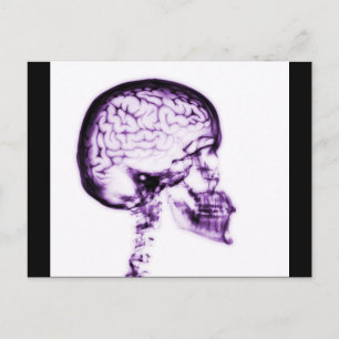 CARTÃO POSTAL CÉREBRO DO CÉREBRO DO CÉREBRO-RAIO X - ROPULADA