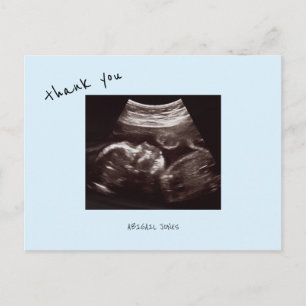 Cartão Postal Chuva de Bebê Ultrassom Fofo Azul Gelado Obrigado
