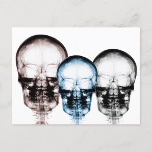 Cartão Postal Cores mistas Skeleton de visão de raios X