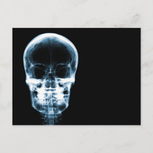 CARTÃO POSTAL CRÂNIO DE ESQUELETO COM VISÃO DE RAIOS-X - AZUL