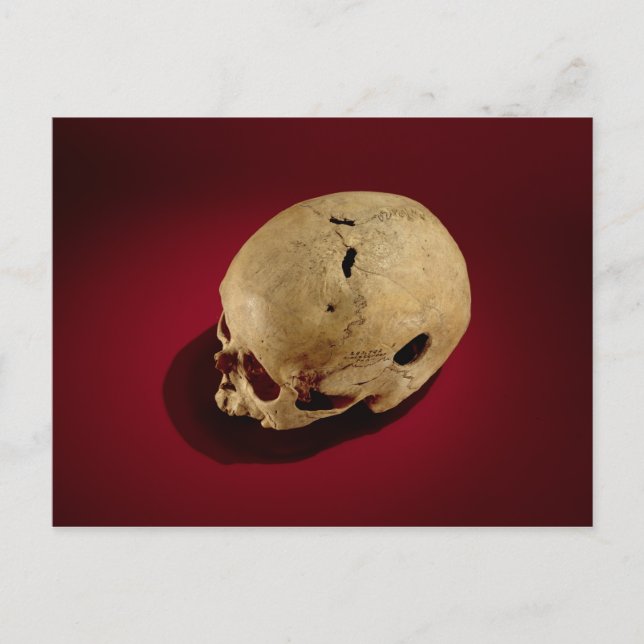 Cartão Postal Crânio Trepanado (Frente)