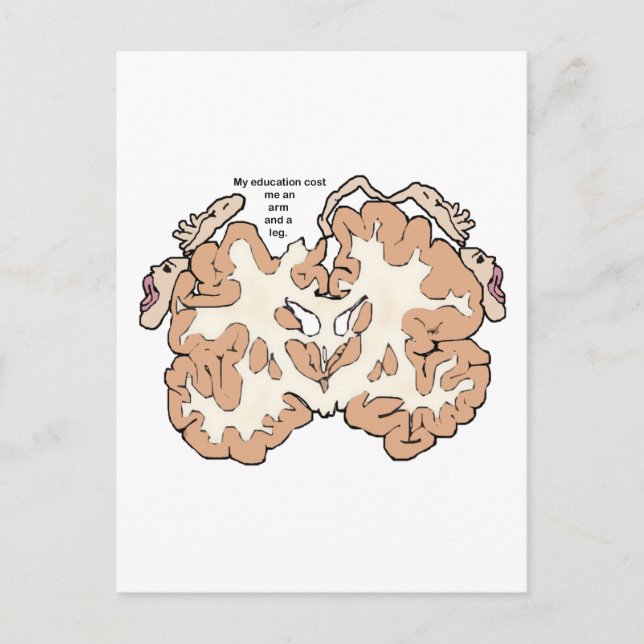 Cartão Postal Custa um braço e uma perna homunculada (Frente)