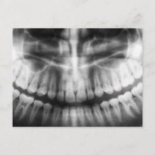 Cartão Postal Dentes de Raio X Sorriso de Boca Preto e Branco