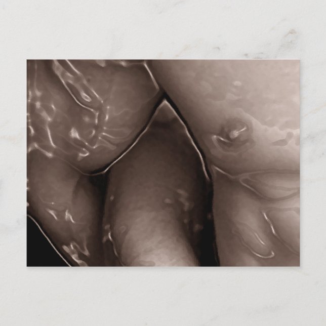 Cartão Postal Embrace esticado (Frente)