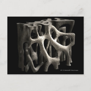Cartão Postal Estrutura do osso com osteoporose