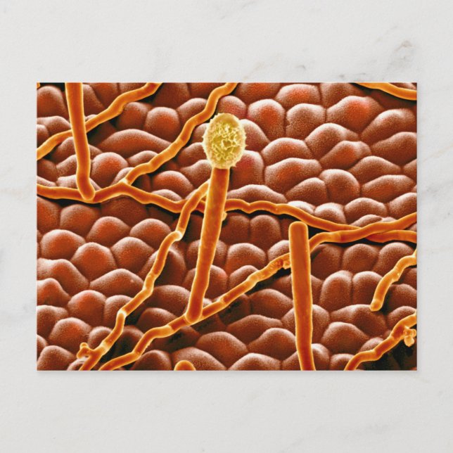 Cartão Postal Fungo do oídio pulverulento na poinsétia (Frente)